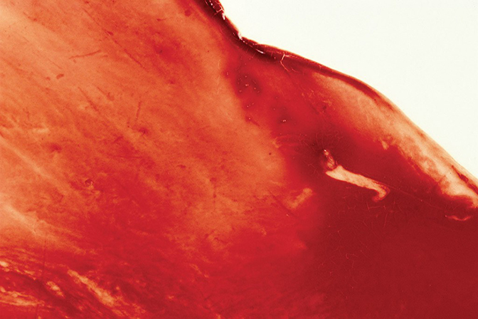 Andres Serrano, Blood and Semen V, 1987